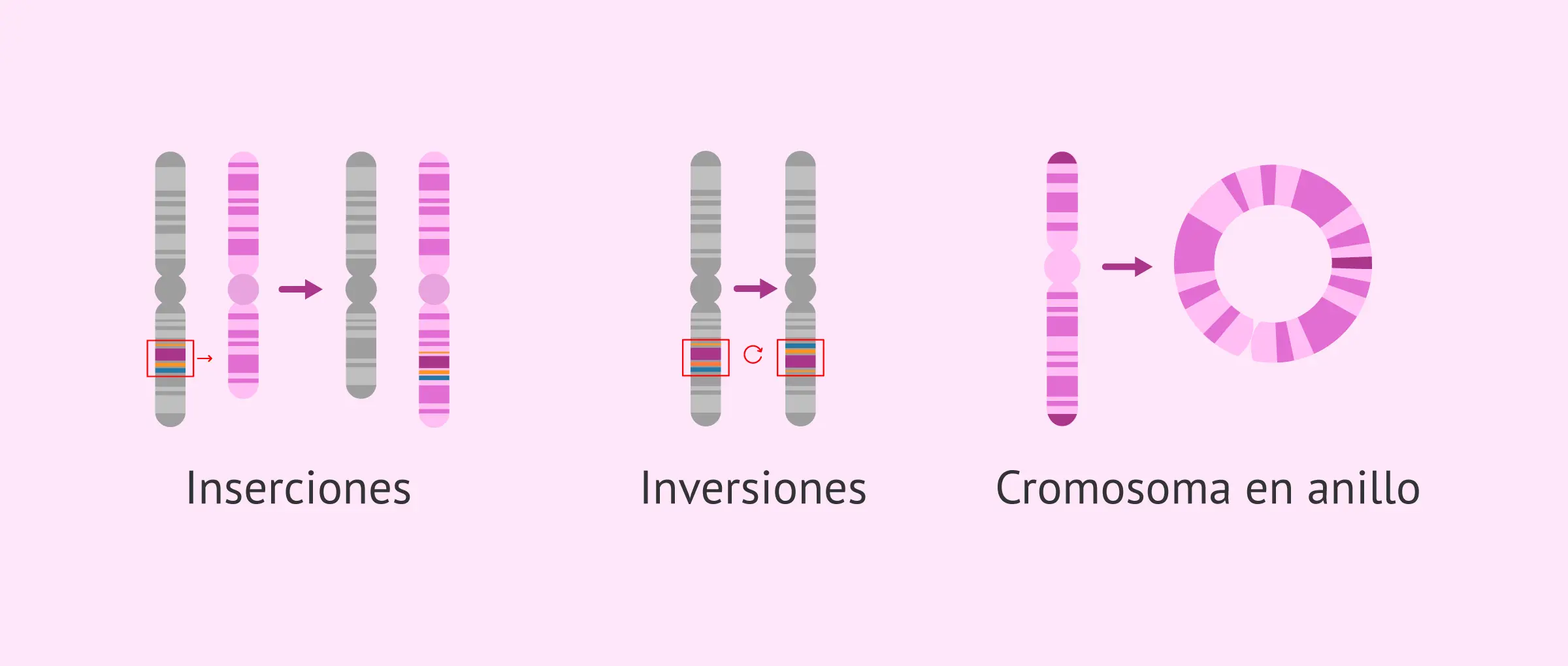 Anomalías Estructurales: Inversión Cromosómica - Qué significa tener un cromosoma invertido anomalias estructurales inversion - Qué significa tener un cromosoma invertido